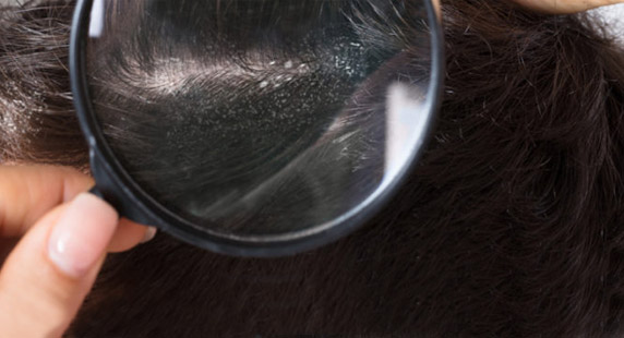 Growth Factor Hair Treatment