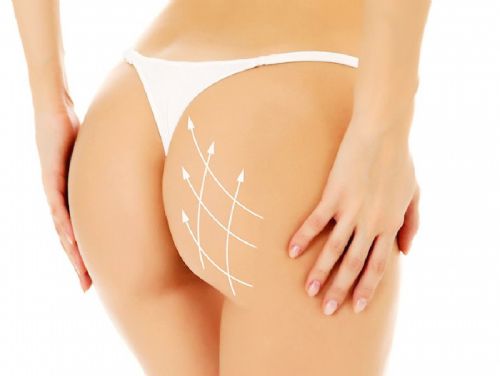 BBL - Brazilian Butt Lift